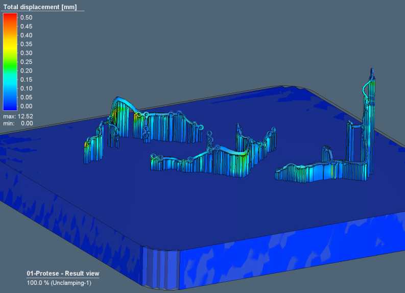 设计仿真 | Simufact Additive——3D打印仿真软件在医疗行业的应用 第8张